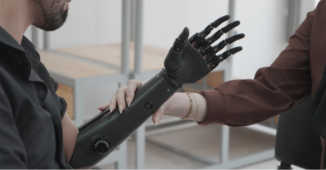 Close-up of a modern bionic arm being fitted by a specialist